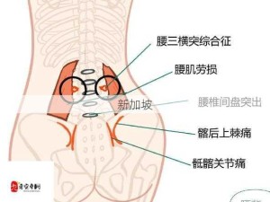 使劲低头后突感背疼，原因何在？如何应对？