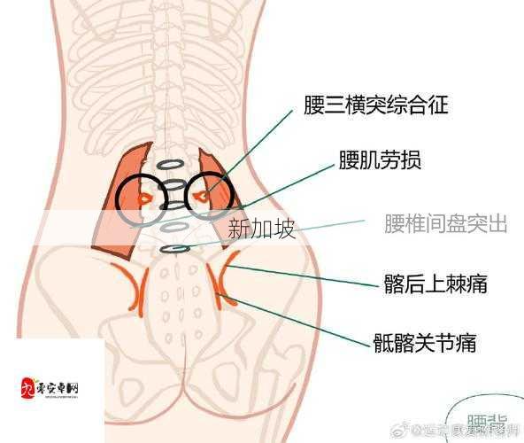 使劲低头后突感背疼，原因何在？如何应对？